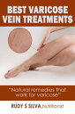 Best Varicose Vein Treatments “Discover Little Know Natural Remedies for Varicose Veins”【電子書籍】 rudy silva