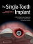 The Single-Tooth Implant: