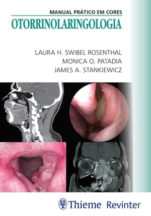 Otorrinolaringologia Manual Pr tico em Cores【電子書籍】 Laura H. Swibel Rosenthal