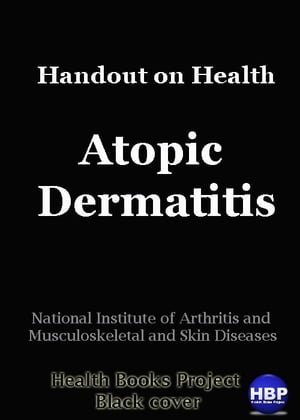 Atopic DermatitisHandout on Health【電子書籍】[ National Institute of Arthritis and Musculoskeletal and Skin Diseases ]