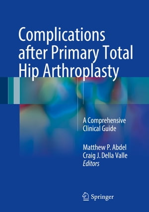 Complications after Primary Total Hip Arthroplasty A Comprehensive Clinical GuideŻҽҡ