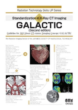 Standardization in X-Ray CT Imaging-GALACTIC-(Second edition)【電子書籍】