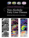 ＜p＞＜em＞Clinical Dilemmas in Non-Alcoholic＜/em＞ ＜em＞Fatty Liver Disease＜/em＞ offers hepatologists practical, up-to-date and expert guidance on the most topical dilemmas, difficulties and areas of controversy/difficulty surrounding this ever-increasing area of liver disease they face in daily practice.＜/p＞ ＜p＞Roger Williams and Simon Taylor-Robinson, two of Europe’s leading hepatologists, have recruited leading figures from across the world to assist them, resulting in a truly international approach. Each chapter covers a specific area of difficulty, containing clear learning points and providing evidence-based expert guidance on the latest hot topics in clinical management such as:＜/p＞ ＜ul＞ ＜li＞Is NAFLD different in absence of Metabolic Syndrome?＜/li＞ ＜li＞Are the pros outweighed by the cons of obtaining a liver biopsy?＜/li＞ ＜li＞Is progression to cirrhosis more likely in children with NAFLD?＜/li＞ ＜li＞What are the dangers as well as the true benefits of bariatric surgery?＜/li＞ ＜li＞How is it best to use antifibrotic agents in clinical practice?＜/li＞ ＜/ul＞ ＜p＞＜em＞Clinical Dilemmas in Non-Alcoholic＜/em＞ ＜em＞Fatty Liver Disease＜/em＞ provides the answers to the questions and challenges that clinicians face every day in this area. It is essential reading for hepatologists of all levels and researchers in hepatology, as well as all those involved in the care of patients with NAFLD, including gastroenterologists, pathologists and specialist hepatology nurses.＜/p＞画面が切り替わりますので、しばらくお待ち下さい。 ※ご購入は、楽天kobo商品ページからお願いします。※切り替わらない場合は、こちら をクリックして下さい。 ※このページからは注文できません。