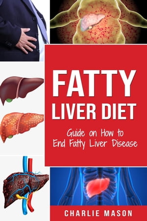 ŷKoboŻҽҥȥ㤨Fatty Liver Diet: Guide on How to End Fatty Liver DiseaseŻҽҡ[ Charlie Mason ]פβǤʤ350ߤˤʤޤ
