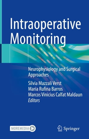 Intraoperative Monitoring