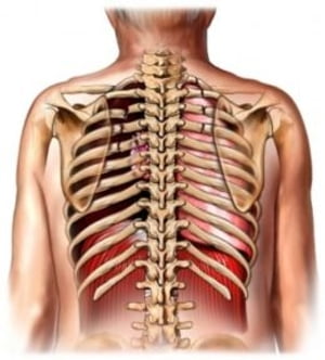 Broken Ribs: Causes, Symptoms and Treatments