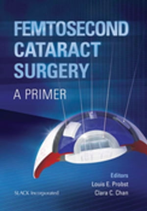 Femtosecond Cataract Surgery A PrimerŻҽҡ