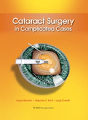 Cataract Surgery in Complicated CasesŻҽҡ