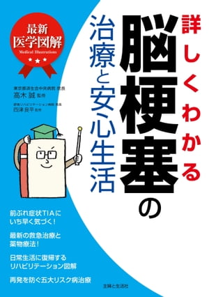 最新医学図解　詳しくわかる脳梗塞の治療と安心生活