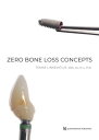 楽天楽天Kobo電子書籍ストアZero Bone Loss Concepts【電子書籍】[ Tomas Linkevi?ius ]