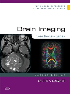 Brain Imaging: Case Review Series E-Book