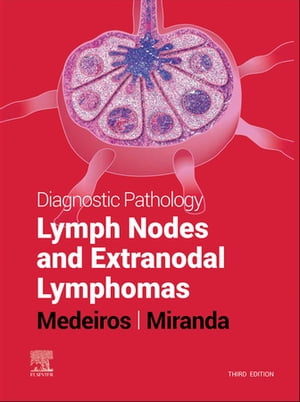 Diagnostic Pathology: Lymph Nodes and Extranodal Lymphomas E-Book