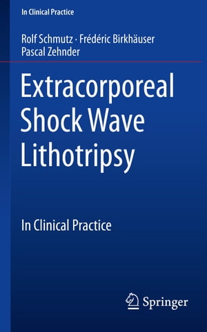 Extracorporeal Shock Wave Lithotripsy In Clinical Practice