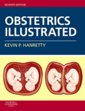 Obstetrics Illustrated E-Book