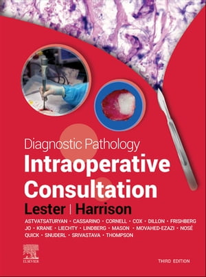 楽天楽天Kobo電子書籍ストアDiagnostic Pathology: Intraoperative Consultation E-Book Diagnostic Pathology: Intraoperative Consultation E-Book【電子書籍】[ Susan C. Lester, MD, PhD ]