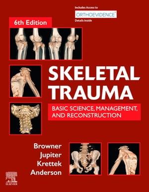 楽天楽天Kobo電子書籍ストアSkeletal Trauma E-Book Basic Science, Management, and Reconstruction. 2 Vol Set【電子書籍】[ Bruce D. Browner ]