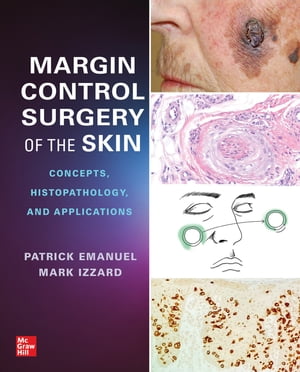 Margin Control Surgery of the Skin: Concepts, Histopathology, and Applications【電子書籍】 Patrick Emanuel