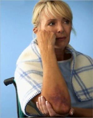 How To Get Rid of Bruises【電子書籍】[ Marco Nunez ]