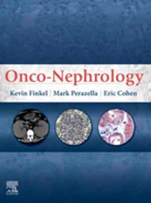 Onco-Nephrology