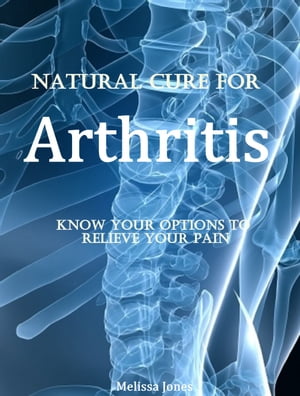 Natural Cure for Arthritis Know Your Options to 