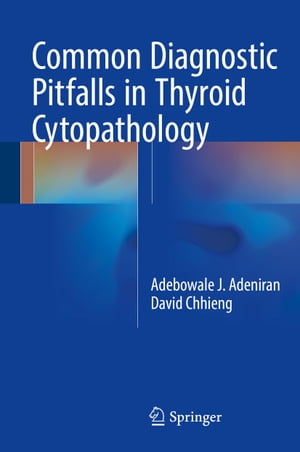 Common Diagnostic Pitfalls in Thyroid Cytopathology【電子書籍】 Adebowale J. Adeniran