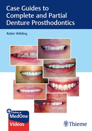 Case Guides to Complete and Partial Denture Prosthodontics【電子書籍】[ Robin Wilding ]