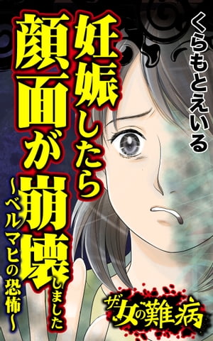 ザ・女の難病　妊娠したら顔面が崩壊しました〜ベルマヒの恐怖〜／私の人生を変えた女の難病Vol.2