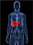 An Informative Guide About Liver Cancer