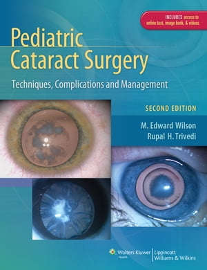 Pediatric Cataract Surgery Techniques, Complications and ManagementŻҽҡ[ M. Edward Wilson ]