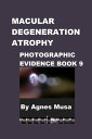 Macular Degeneration Atrophy, Photographic Evidence Book 9【電子書籍】 Agnes Musa