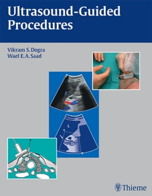 Ultrasound-Guided Procedures