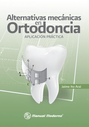 Alternativas mecánicas en Ortodoncia. Aplicación práctica