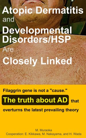 Atopic Dermatitis and Developmental Disorders/HSP Are Closely Linked