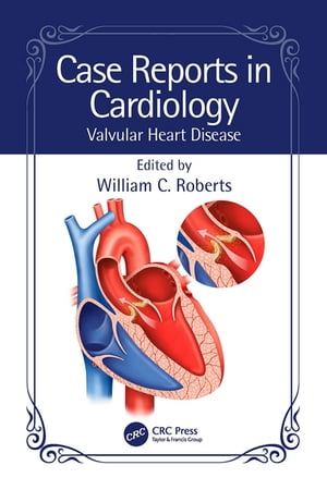 ŷKoboŻҽҥȥ㤨Case Reports in Cardiology Valvular Heart DiseaseŻҽҡۡפβǤʤ7,325ߤˤʤޤ