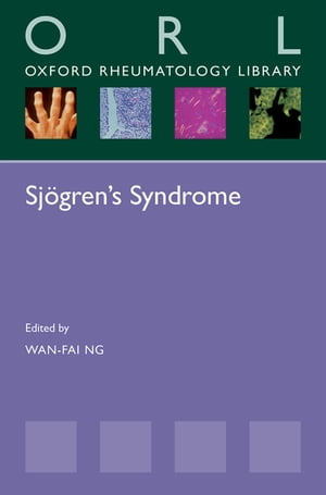 Sjögren's Syndrome