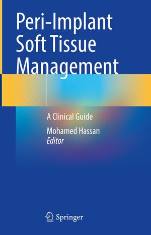 Peri-Implant Soft Tissue Management A Clinical GuideŻҽҡ