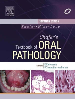 Shafer 039 s Textbook of Oral Pathology【電子書籍】 Arya Rajendran