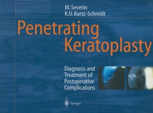 Penetrating Keratoplasty