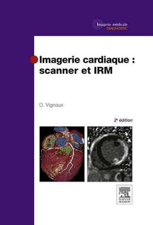 Imagerie cardiaque : scanner et IRM【電子書籍】[ Olivier Vignaux ]