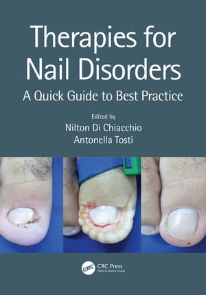 Therapies for Nail Disorders A Quick Guide to Best Practice【電子書籍】