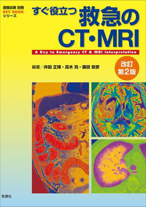 すぐ役立つ救急のCT・MRI改訂第2版