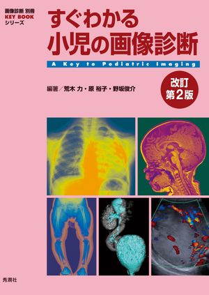 すぐわかる小児の画像診断 改訂第2版