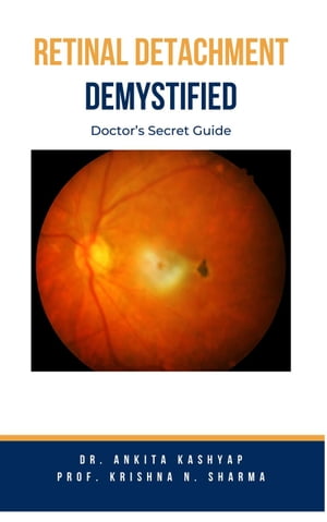 Retinal Detachment Demystified: Doctor's Secret Guide