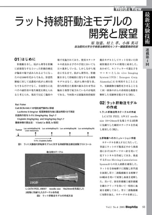 最新実験技術 : 第4回 ラット持続肝動注モデルの開発と展望