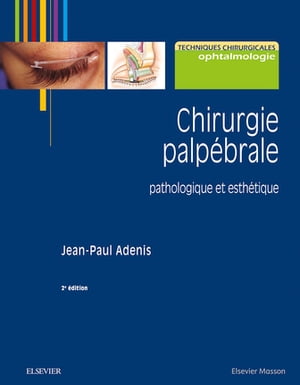 Chirurgie palpébrale