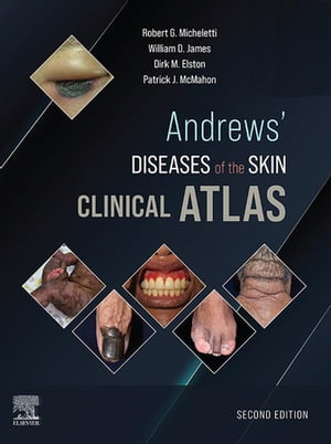 ŷKoboŻҽҥȥ㤨Andrews' Diseases of the Skin Clinical Atlas,E-Book Andrews' Diseases of the Skin Clinical Atlas,E-BookŻҽҡ[ Robert G. Micheletti ]פβǤʤ27,776ߤˤʤޤ