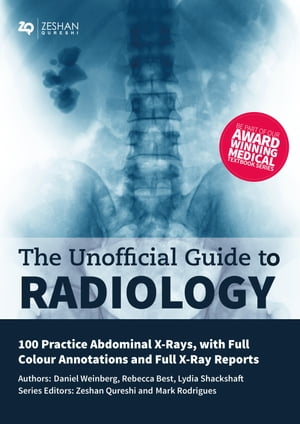 Unofficial Guide to Radiology: 100 Practice Abdominal X-Rays