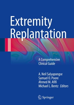 Extremity Replantation