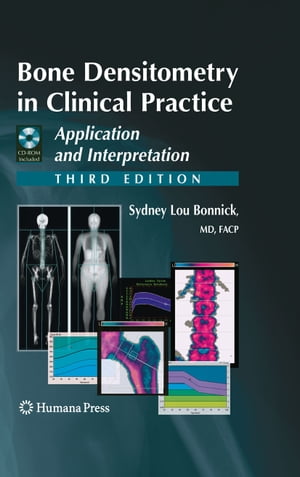 Bone Densitometry in Clinical Practice