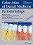 Color Atlas of Dental Medicine: Periodontology